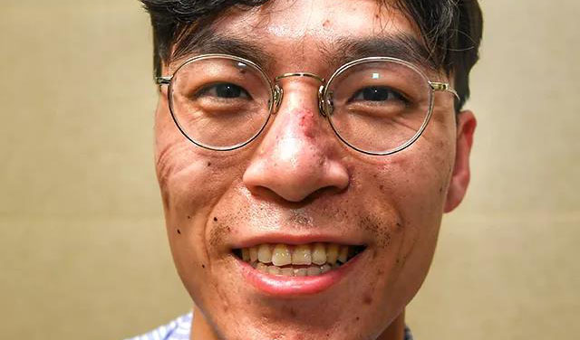 這些刻在我們臉上的印痕，會成為永恒的記憶！