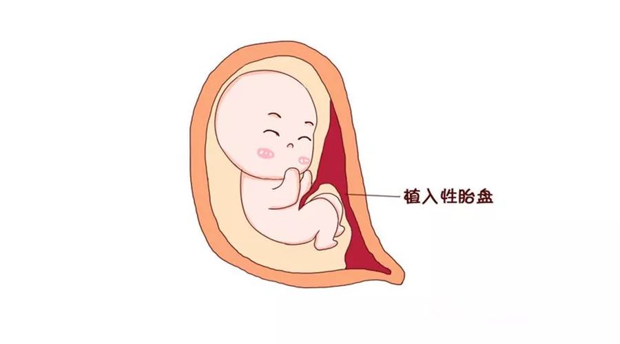 此外卵巢功能、激素代謝均受高級神經(jīng)中樞的控制調(diào)節(jié)